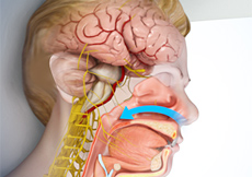 Centeral Sleep Apnea